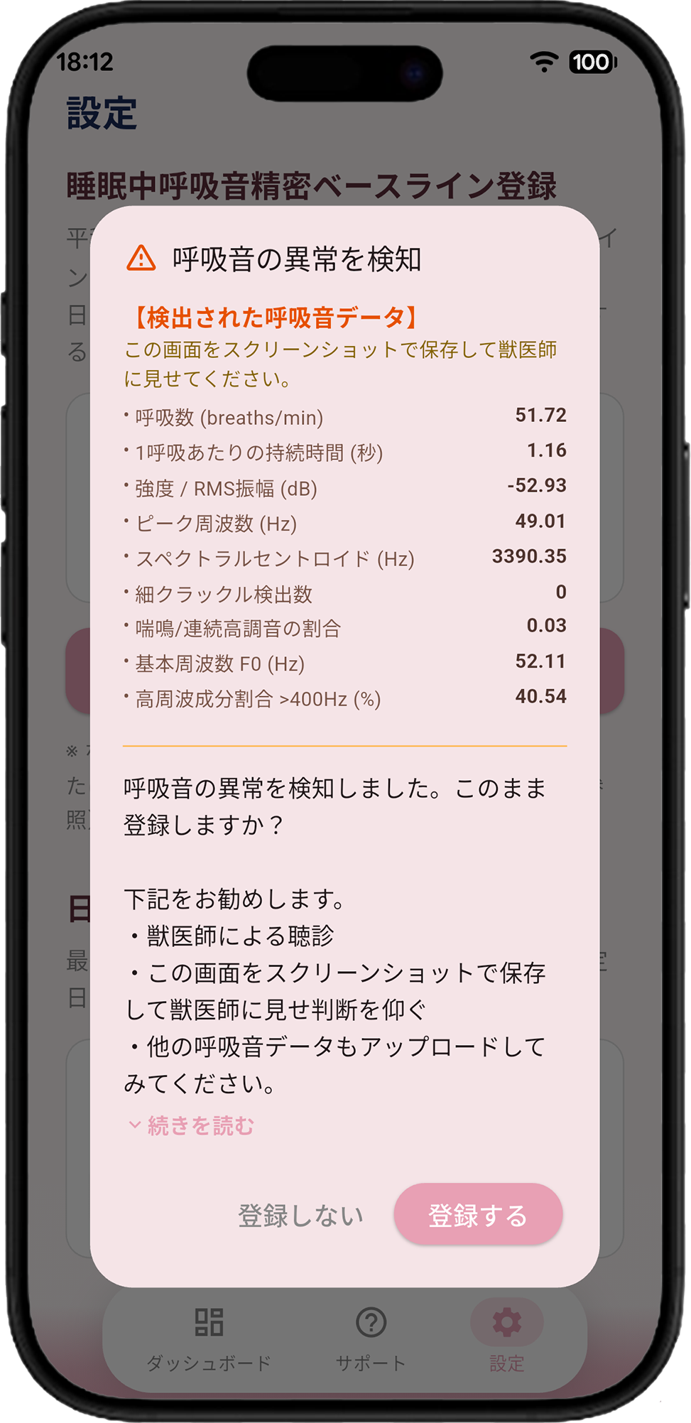 呼吸音の異常を検知しましたダイアログ